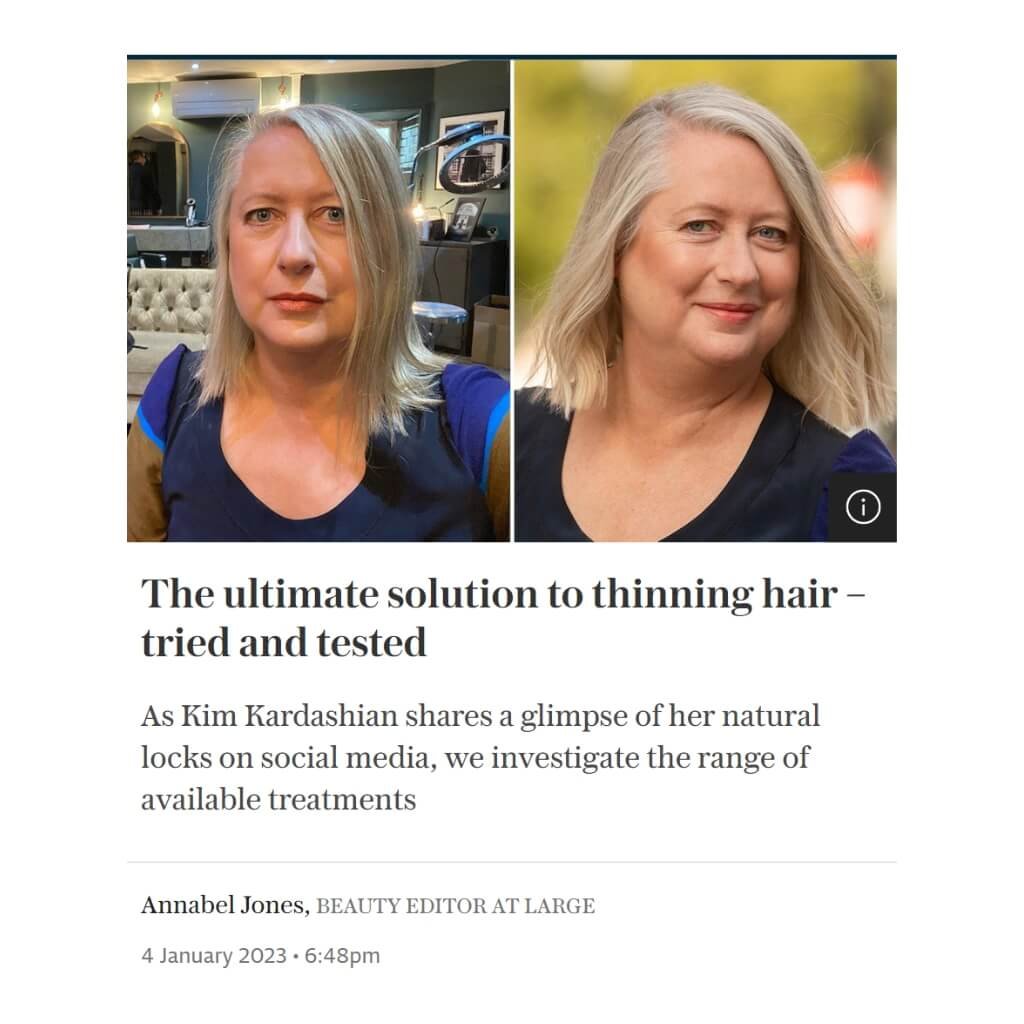 The Telegraph ultimate solution to thinning hair