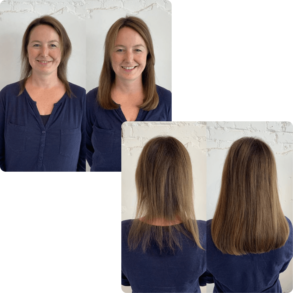 Thinning Hair Transformation With Extensions